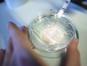 عصر علاج الأمراض عن طريق تعديل الحمض النووي اقترب كثيراً - المصدر: بلومبرغ