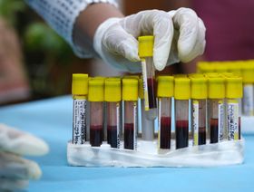 عامل صحي يمسك صينية عينات الدم - المصدر: بلومبرغ