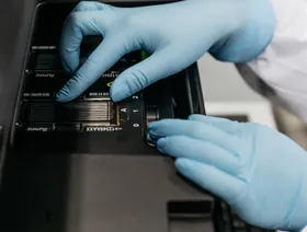 فني يضع شريحة زجاجية لخلايا التدفق داخل جهاز تسلسل الحمض النووي التابع لشركة "إيلومينا" داخل مختبر الأحماض النووية البلازمية في معهد لي كا شينغ للعلوم الصحية بالجامعة الصينية في هونغ كونغ، الصين - بلومبرغ