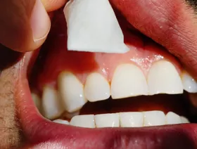 رجل يضع كيس 'زين' بين لثته وشفته - بلومبرغ