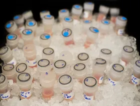 لقاح سرطان يبدو واعداً ويتطلب استثماراً