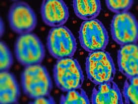 المصدر - المصدر: بلومبرغ