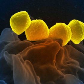 صورة بالمجهر الإلكتروني لبكتيريا المجموعة "ألف" العقدية (المكورات العقدية المقيحة) - بي إس آي بي/يونيفرسال إيمجز