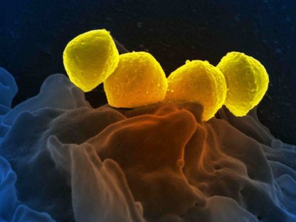 صورة بالمجهر الإلكتروني لبكتيريا المجموعة "ألف" العقدية (المكورات العقدية المقيحة) - بي إس آي بي/يونيفرسال إيمجز